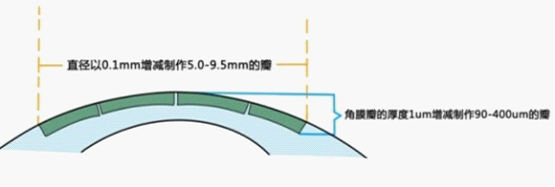 近视眼手术安全吗？专家谈个性化对安全治近视的重要性